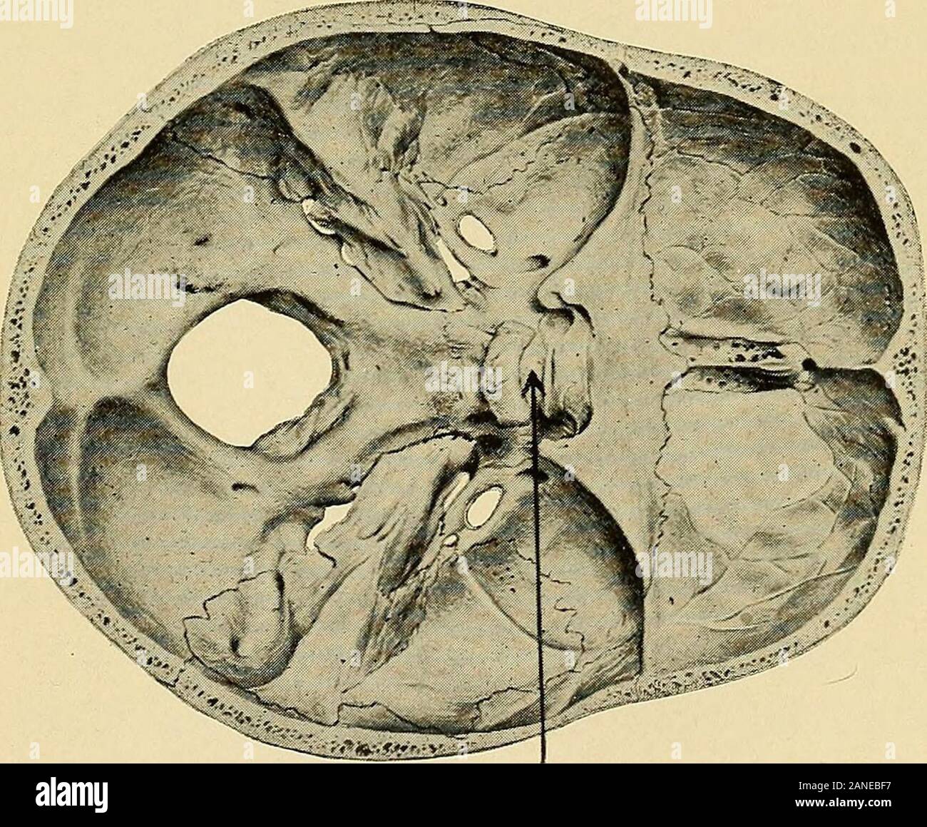 Las glándulas de la vida : contribución al estudio de organotherapy .  Cuerpo pituitario sección mediana del cerebro mostrando el cuerpo  pituitario. Desde Sobottas Atlas de Anatomía Humana, por la amable  autorización