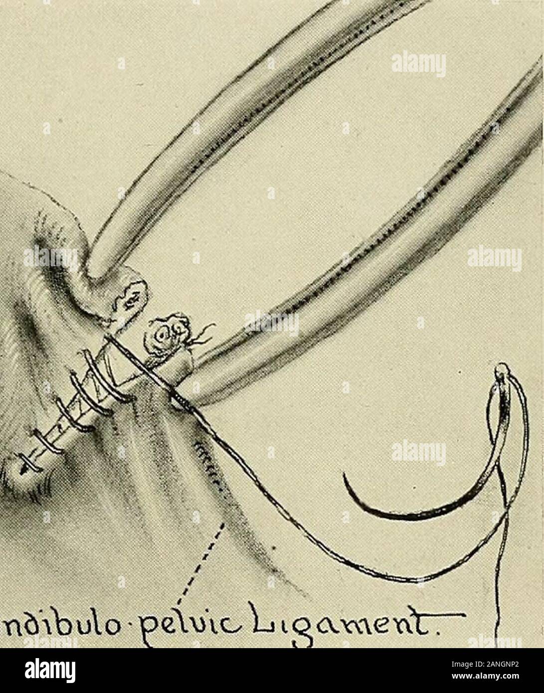 Ooforectomia bilateral.  Download Scientific Diagram