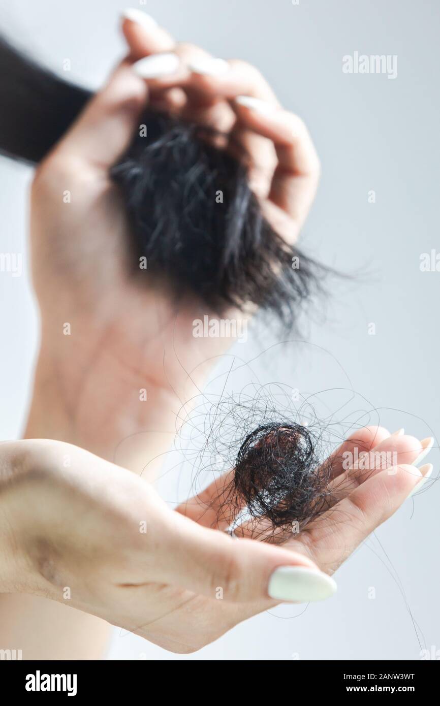 Caída de cabello de la Mujer / Problema de pérdida de cabello. Foto de stock