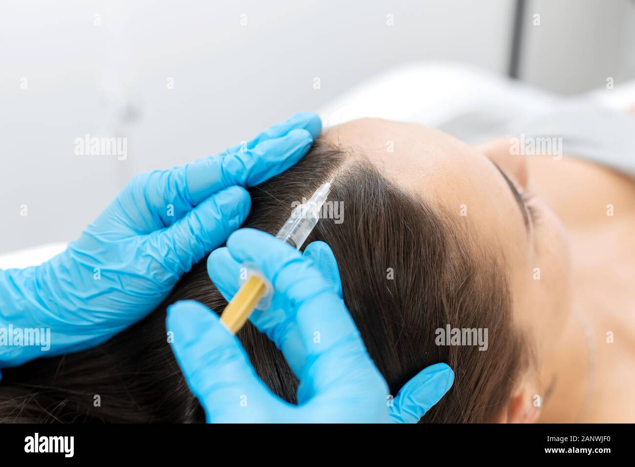 Cerca, el esteticista realiza inyecciones de vitaminas en el cuero cabelludo  para fortalecer el cabello Fotografía de stock - Alamy