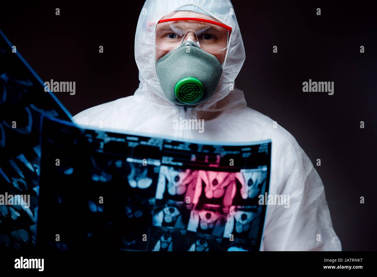 El hombre médico en el blanco hazmat protector gafas de respiración Hold examina los efectos en los pulmones humanos y los órganos reproductivos neumonía epidemia coronavirus Foto de stock