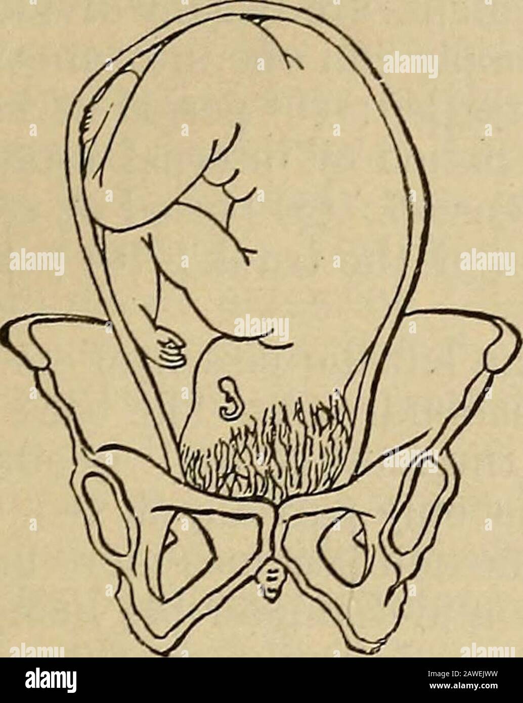 ObstetricsA manual para estudiantes y practicantes . escriba cada uno