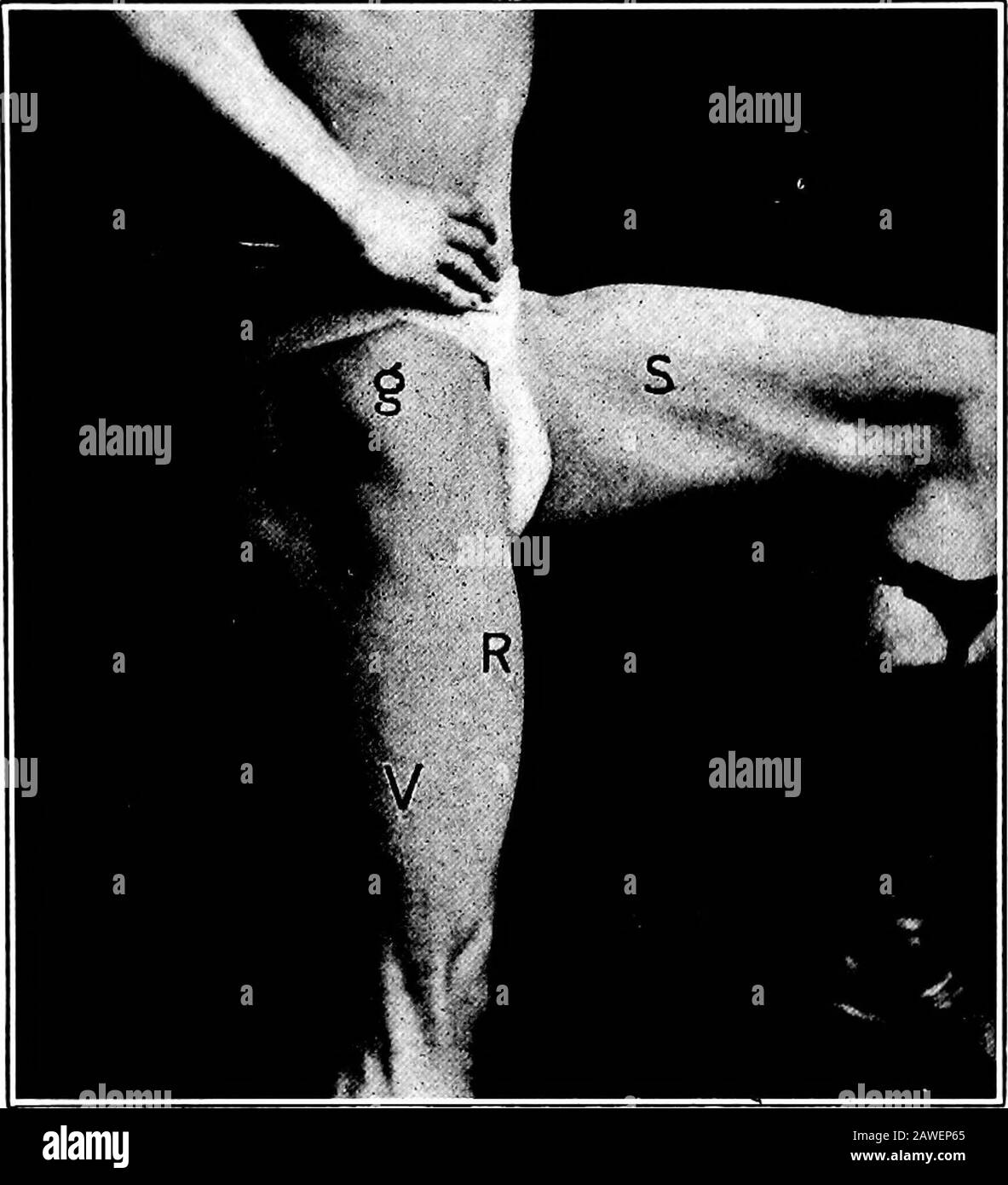 Anatomía aplicada y kinesiología, el mecanismo del movimiento muscular . lecturves alrededor del lado interior del muslo, pasando detrás del innercondyle y luego hacia adelante a su inserción. La fascia del muslo es una hoja gruesa de tejido conectivo fibroso que envuelve el muslo justo debajo de la piel. Acción.—la posición del sartorius, curvándose alrededor de los lados frontal e interior del muslo, hace difícil aprender mucho de la itsaction por medio de un estudio del esqueleto. Su acción aislada, bajo la influencia de la electricidad, flexiona tanto la cadera como la rodilla, como cabe esperar de su posición general. YO Foto de stock