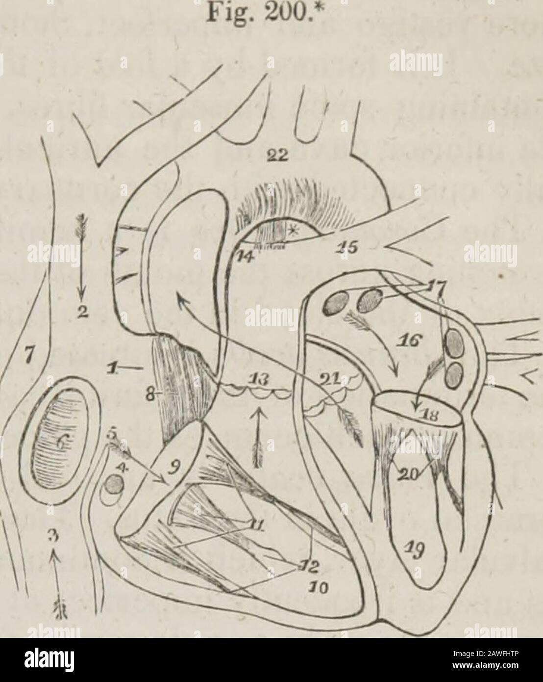 Un sistema de anatomía humana, general y especial . d pared posterior, cerca de la par-tición entre las aurículas (septumauricularum). La dirección de estos dos vasos es tal, que el astream forzado a través del superior cava sería dirigido towardsthe auriculo-ventricular opening.In como manera, un arroyo corriendo / hacia arriba por el cava inferior forzaría su corriente contra el septumauricularum; esta es la correcta di-dirección de las dos corrientes de vida duringfoetal. La vena coronaria devuelve sangre de la sustancia del corazón; se abre al auri-cle entre el cava inferior y el Foto de stock