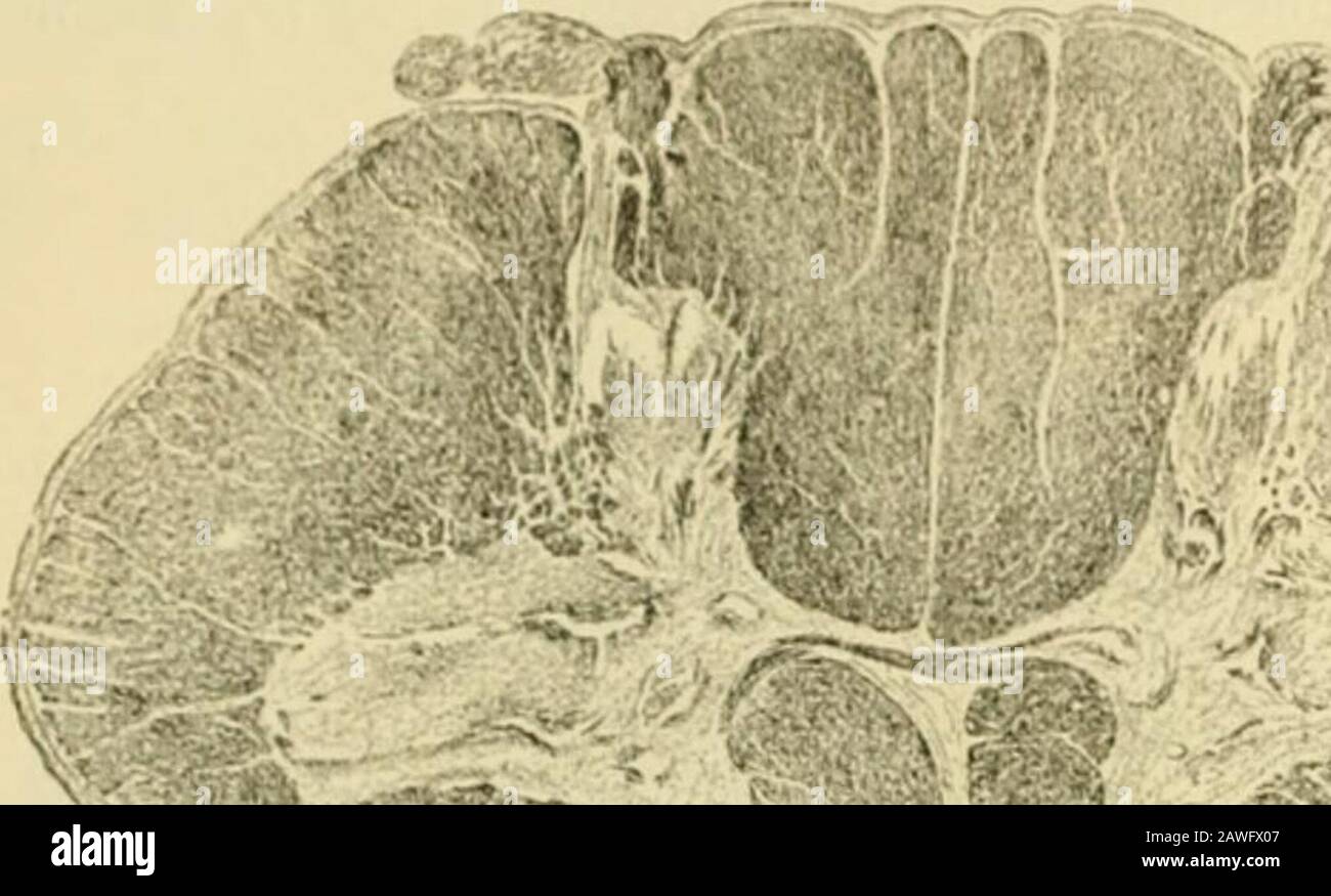 Anatomía humana, incluyendo estructura y desarrollo y consideraciones prácticas . página 1044), surge como axonesde estas neuronas. Las fibras del reflejo anterior al cuerno ventral son todos colaterales, no continuas de las fibras del tallo, la mayor parte de las cuales provienen de las fibras del tracto posterior ascendente. Estos colaterales penetran la materia gris en el borde medio de la cabeza del cuerno posterior, detrás de Clarkescolumn, pero también en parte a través de la substantia Rolandi, y pasan por el ventral orventral-lateralmente, con un curso ligeramente curvado o sigmoide, Foto de stock