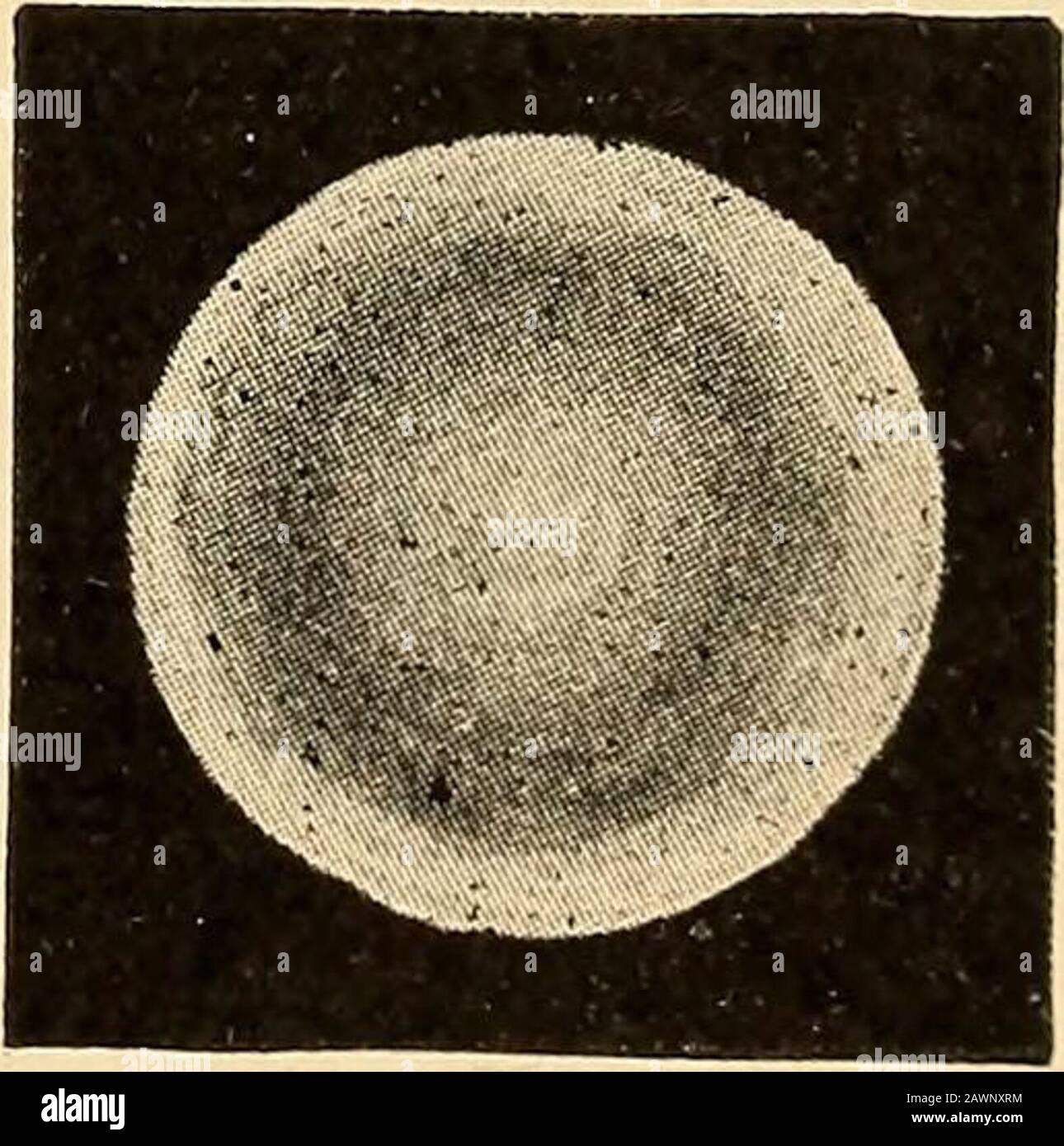 Skiascopy y su aplicación práctica al estudio de la refracción . Fig