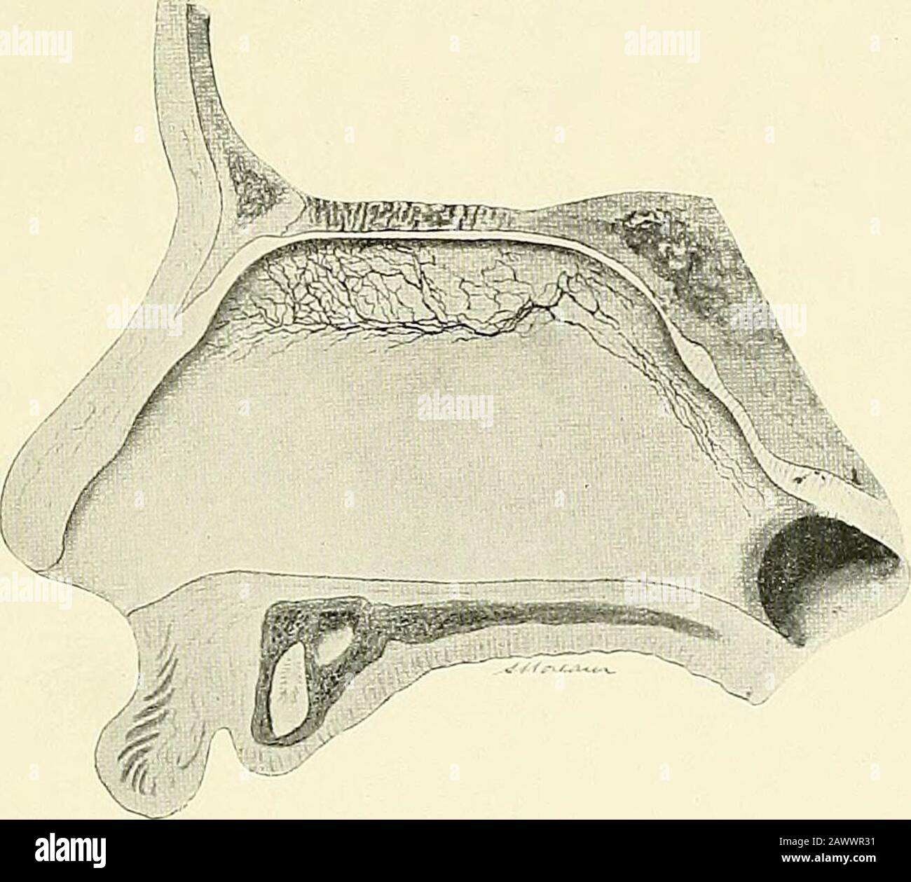 Fiebre Cerebro espinal Placa V Fig 1 De Andre Las Comiciones Del 