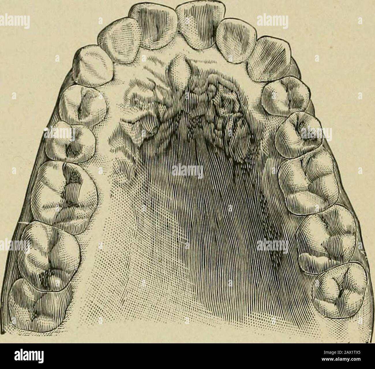 cabin bolsagage measurements