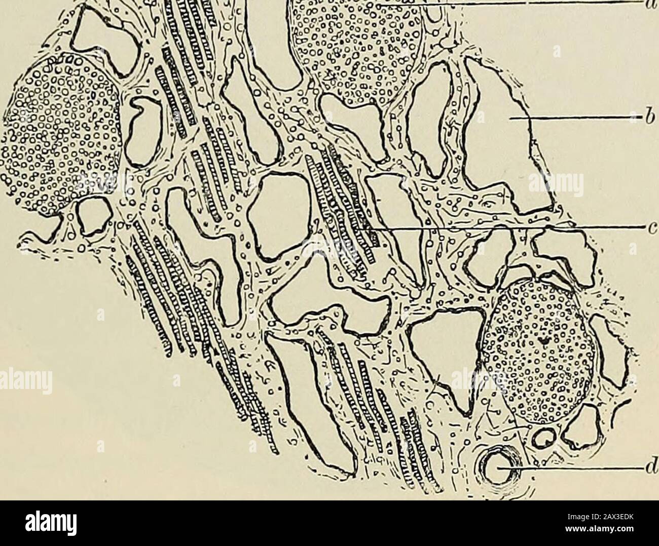 Patología y tratamiento quirúrgico de los tumores. E reticulo ; b
