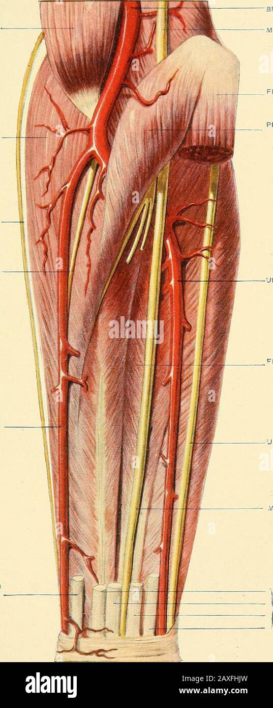 Un manual de cirugía operatoria . los dedos. En la muñeca puede fácilmente empanarse entre los tendones de la flexor carpi radialis yel palmaris longus. Operaciones.—1. En el brazo, el nervio se puede exponer a través de una incisión que se emplea para asegurar la arteria braquial, por ejemplo, en el centro del brazo (página 355). 2. En la muñeca se expone fácilmente a través de una incisionaaproximadamente una pulgada y media de longitud, que es paralela con el thetendon de la flexor carpi radialis y cerca de su lado cubital. Se puede cortar la vena superficial, la fascia se divide y el thenerve puede ser traído inmediatamente Foto de stock