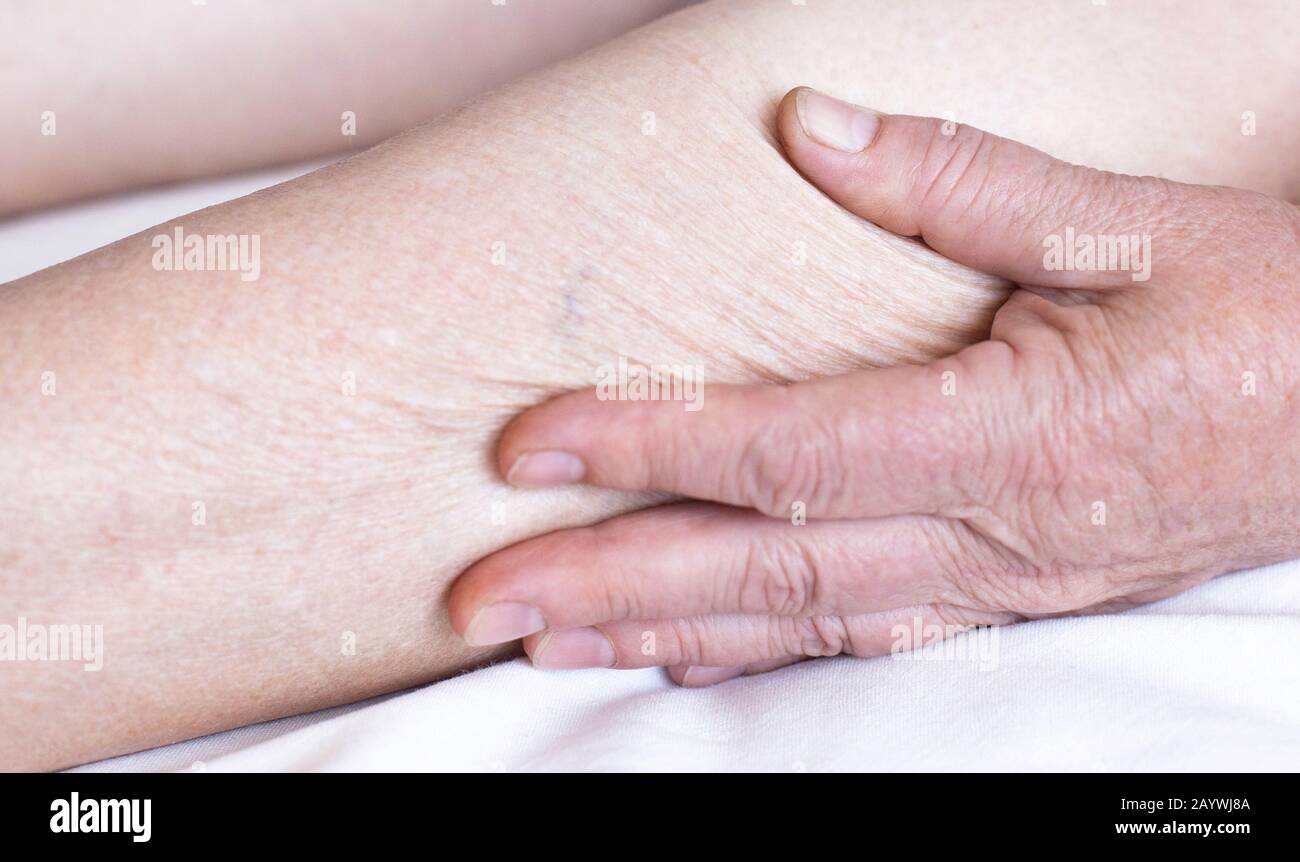 Piel seca en las piernas y brazos de una mujer anciana. El concepto de  cuidado e higiene de la piel en los ancianos Fotografía de stock - Alamy