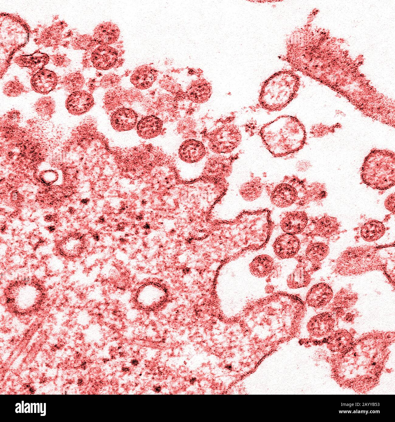 Imagen microscópica de electrones de transmisión de un aislamiento del primer caso de Estados Unidos de COVID-19, anteriormente conocido como 2019-nCoV. Las partículas virales extracelulares esféricas contienen secciones transversales a través del genoma viral, vistas como puntos rojos. Foto de stock