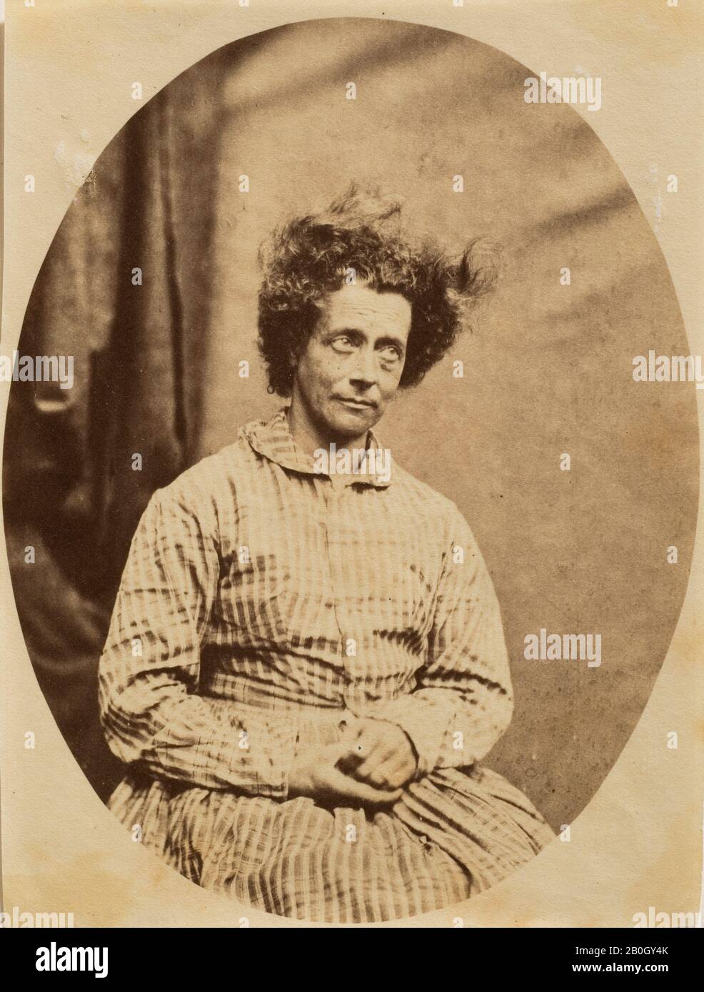 Hugh Welch Diamond, inglés, 1809–1886, Mujer con pelo de pie En El Extremo, 1850, estampado de alcumen, Total: 5 1/4 x 4 pulg. (13.3 x 10.2 cm Foto de stock
