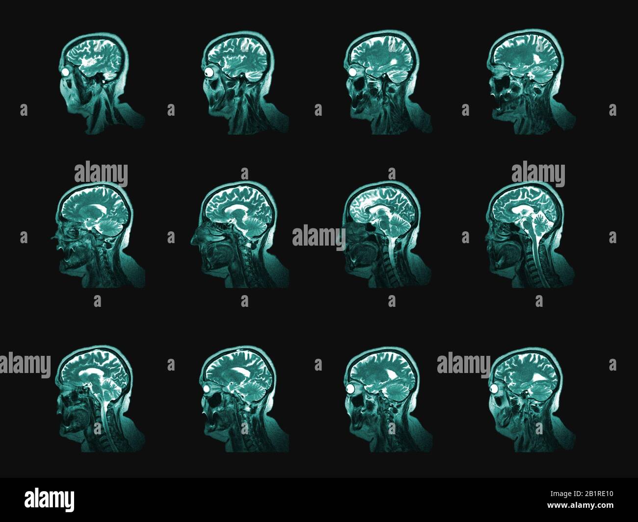 Conjunto de imágenes de tomografía computarizada de cabeza y cerebro  humano. Partición vertical del examen médico o estudio anatómico Fotografía  de stock - Alamy