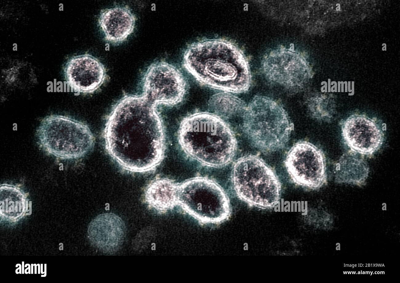 COVID-19. Nuevo Coronavirus SARS-CoV-2 Esta imagen de microscopio electrónico de transmisión muestra SARS-CoV-2, el virus que causa COVID-19, aislado de un paciente en los EE.UU. Partículas del virus se muestran emerger de la superficie de las células cultivadas en el laboratorio. Los picos en el borde exterior de las partículas del virus le dan a los coronavirus su nombre, similar a la corona. Crédito: NIAID-RML Foto de stock