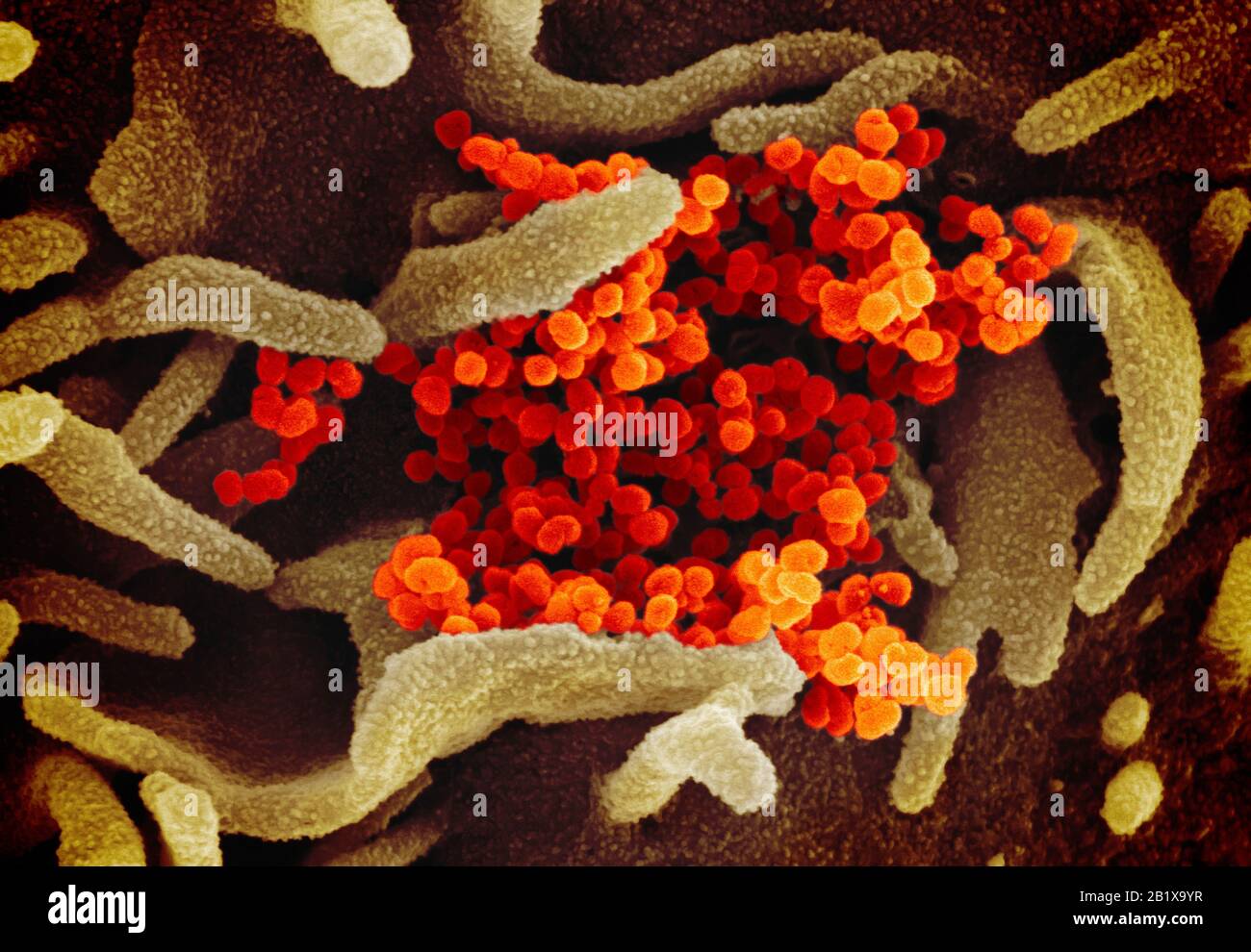 COVID-19. Nuevo Coronavirus SARS-CoV-2 Esta imagen de microscopio electrónico de exploración muestra SARS-CoV-2 (naranja)—también conocido como 2019-nCoV, el virus que causa COVID-19—aislado de un paciente en los Estados Unidos, saliendo de la superficie de células (verdes) cultivadas en el laboratorio. Crédito: NIAID-RML Foto de stock