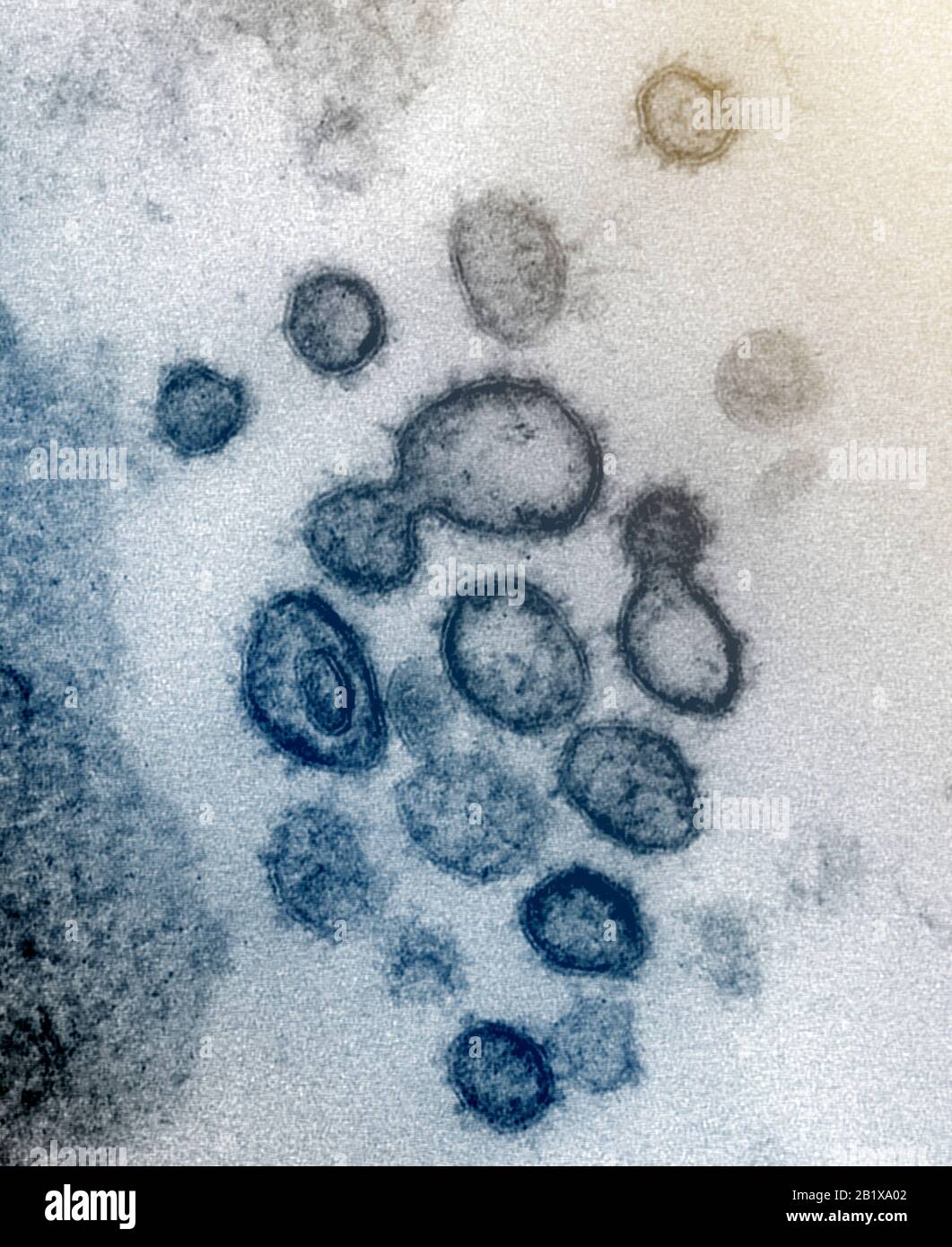 COVID-19. Novel Coronavirus SARS-CoV-2 Esta imagen de microscopio electrónico de transmisión muestra SARS-CoV-2—también conocido como 2019-nCoV, el virus que causa COVID-19—aislado de un paciente en los EE.UU. Las partículas del virus se muestran saliendo de la superficie de las células cultivadas en el laboratorio. Los picos en el borde exterior de las partículas del virus le dan a los coronavirus su nombre, similar a la corona. Crédito: NIAID-RML Foto de stock