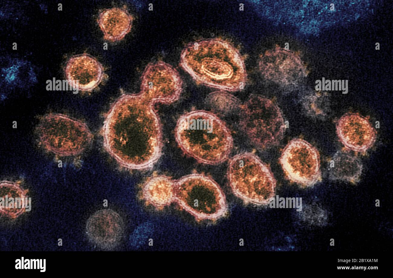COVID-19. Nuevo Coronavirus SARS-CoV-2 Esta imagen de microscopio electrónico de transmisión muestra SARS-CoV-2, el virus que causa COVID-19, aislado de un paciente en los EE.UU. Partículas del virus se muestran emerger de la superficie de las células cultivadas en el laboratorio. Los picos en el borde exterior de las partículas del virus le dan a los coronavirus su nombre, similar a la corona. Crédito: NIAID-RML Foto de stock