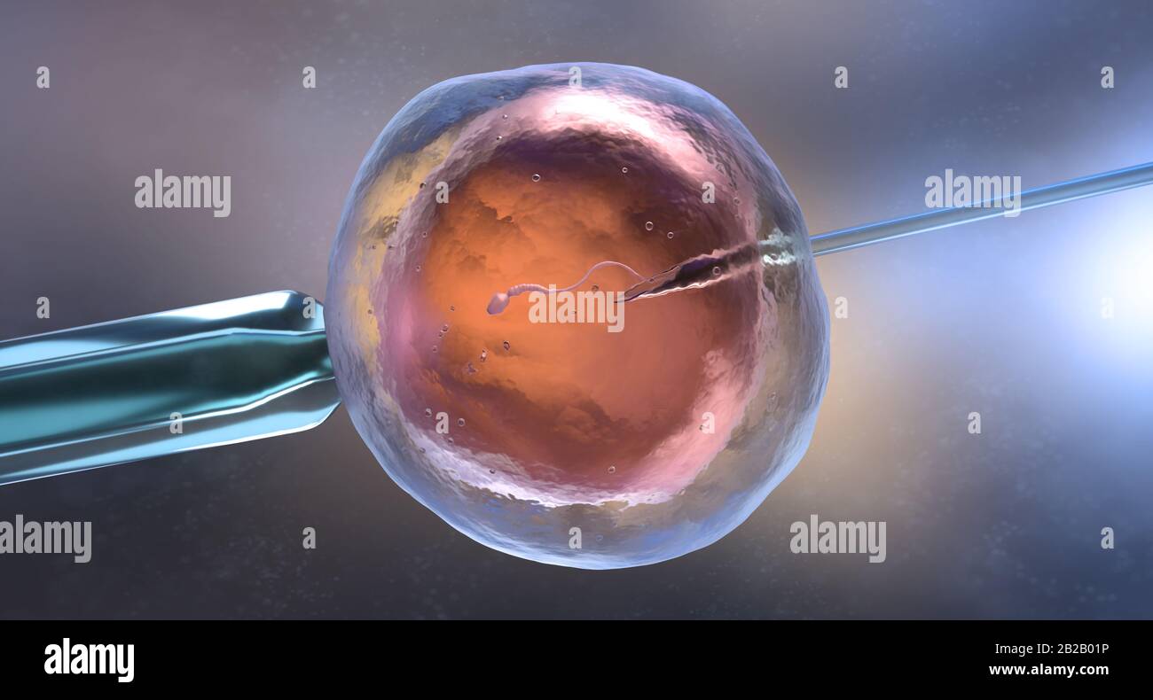 Inseminación artificial o fertilización in vitro. Ilustración 3D Foto de stock