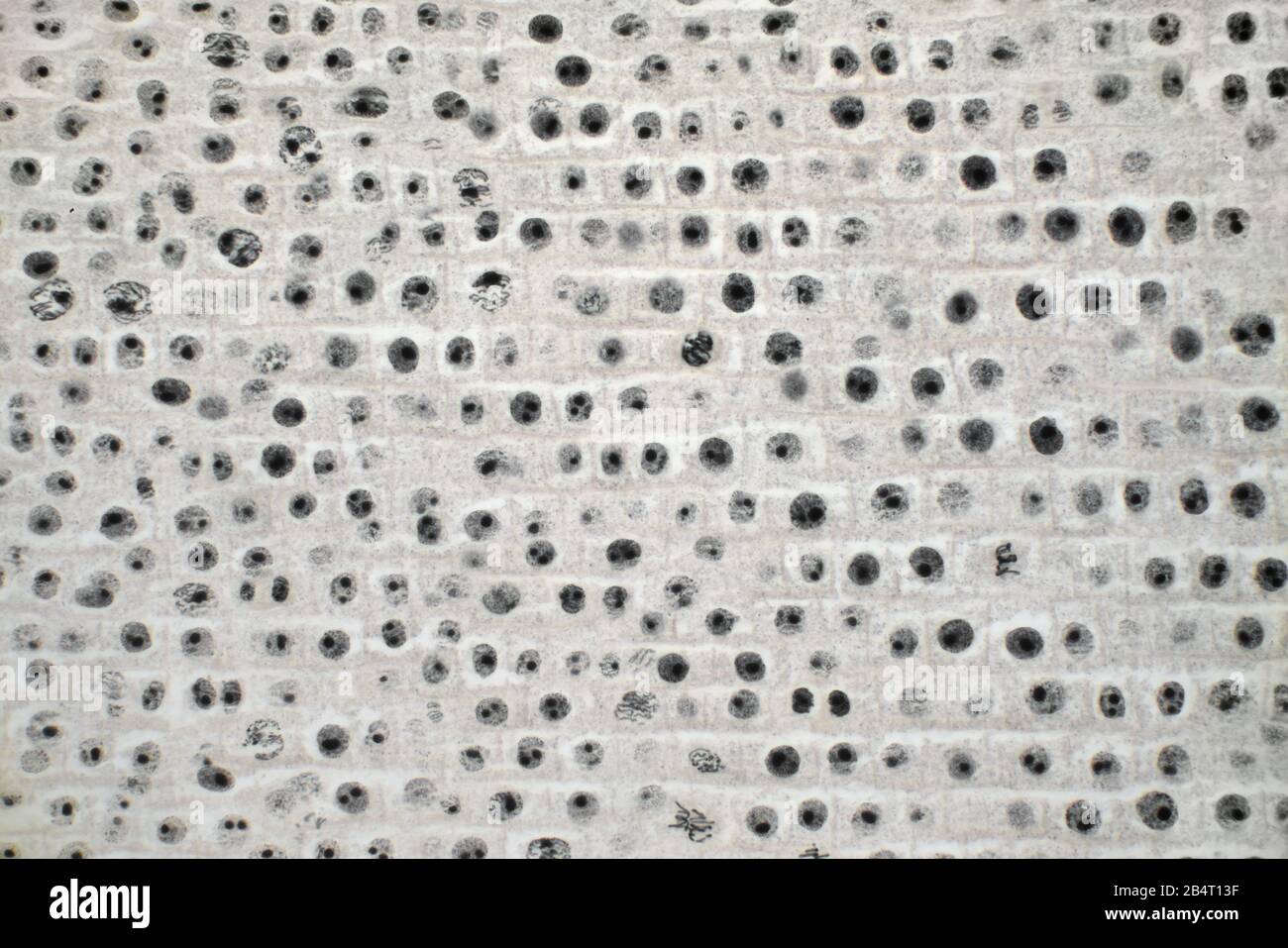División de Cel en punta de raíz de cebolla, mitosis, meiosis Foto de stock