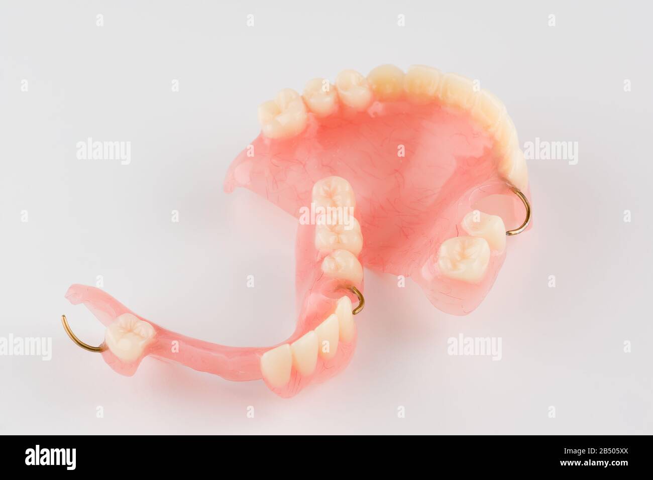 Entender dinámica nosotros Prótesis dentales de acrílico con elementos de sujeción de metal Fotografía  de stock - Alamy
