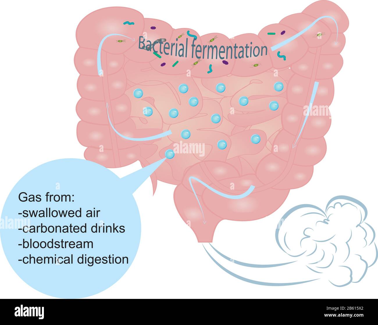 Hinchazón y exceso de gas en el intestino Imagen Vector de stock Alamy
