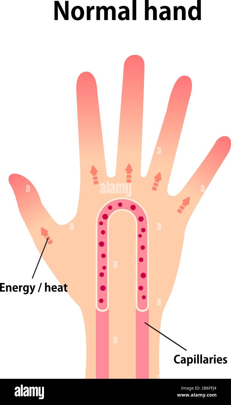 Ilustración de la circulación sanguínea normal de las manos Imagen Vector  de stock - Alamy