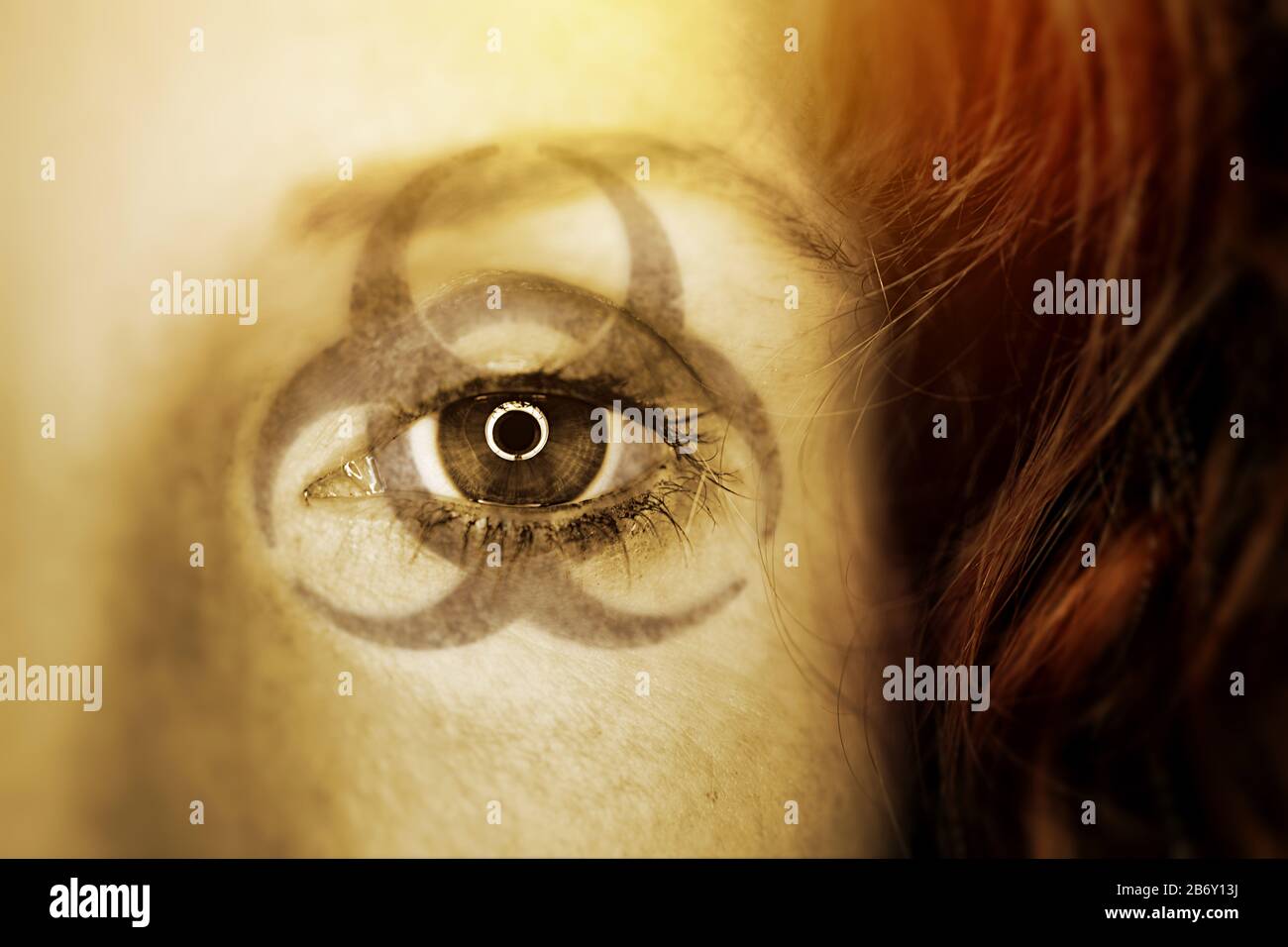 FOTOMONTAGE, Biogefaehrdungszeichen im Gesicht einer Frau, Symbolfoto Coronavirus Foto de stock