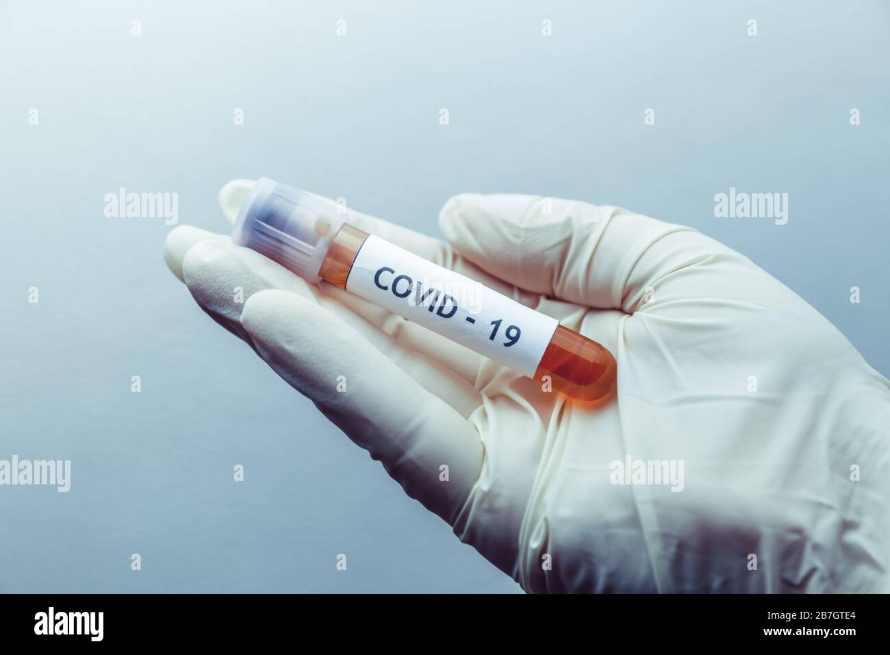 Una muestra de sangre infectada por el coronavirus (covid-19) en un tubo de muestra en mano de un médico científico Foto de stock