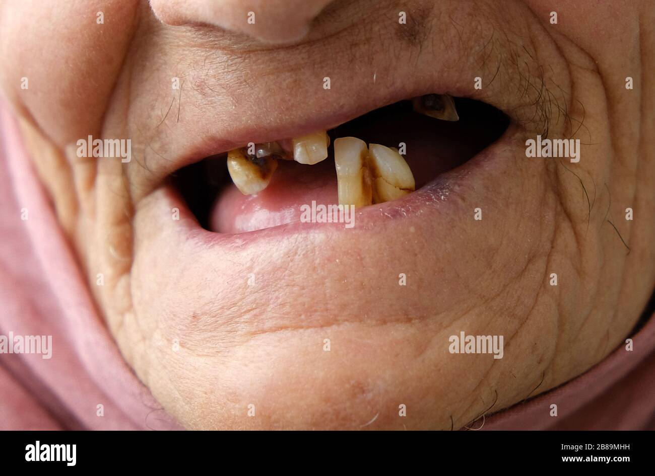 Compartir 66+ boca sin dientes dibujo última - vietkidsiq.edu.vn