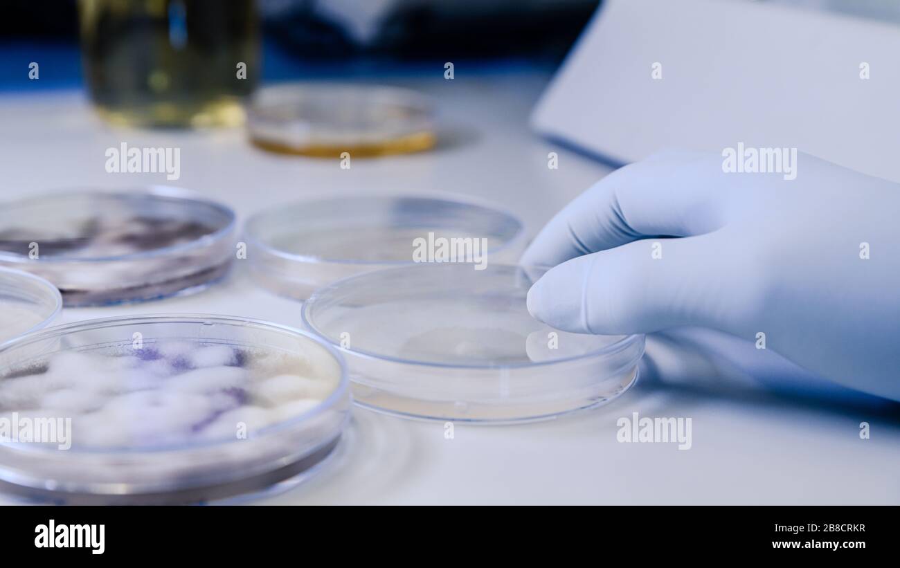 Manipulación científica cultivos microbiológicos en una placa de Petri para la investigación de biociencias farmacéuticas. Concepto de ciencia, laboratorio y estudio de la disea Foto de stock