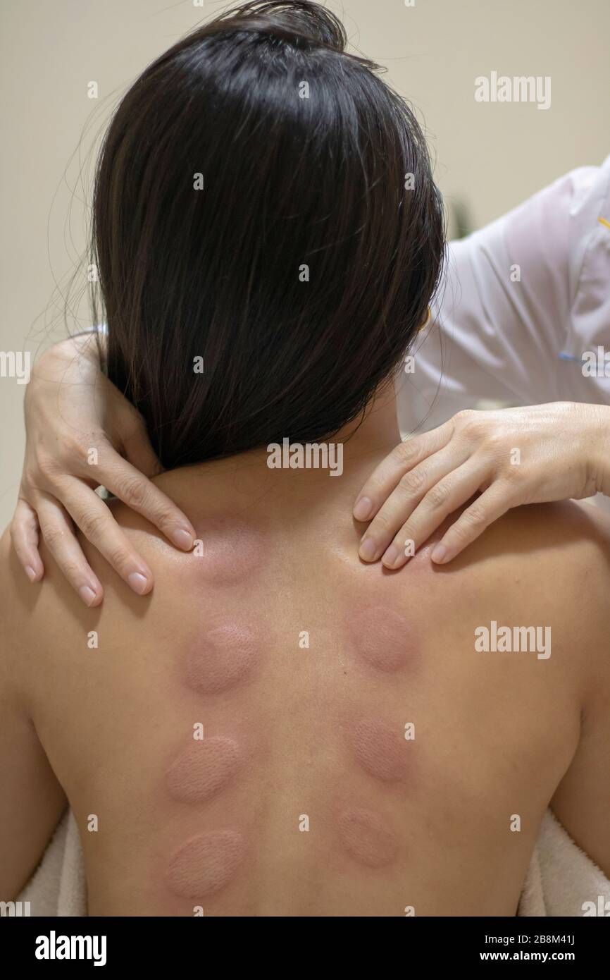 Masaje de cuello para mujer joven en salón de belleza, huellas de masaje al vacío Fotografía de stock imagen imagen
