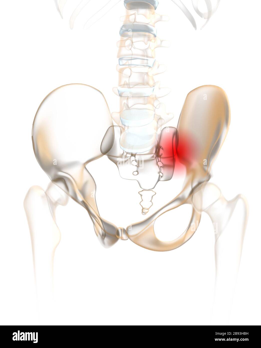 Columna vertebral humana con pelvis y articulación sacroilíaca dolorosa Foto de stock