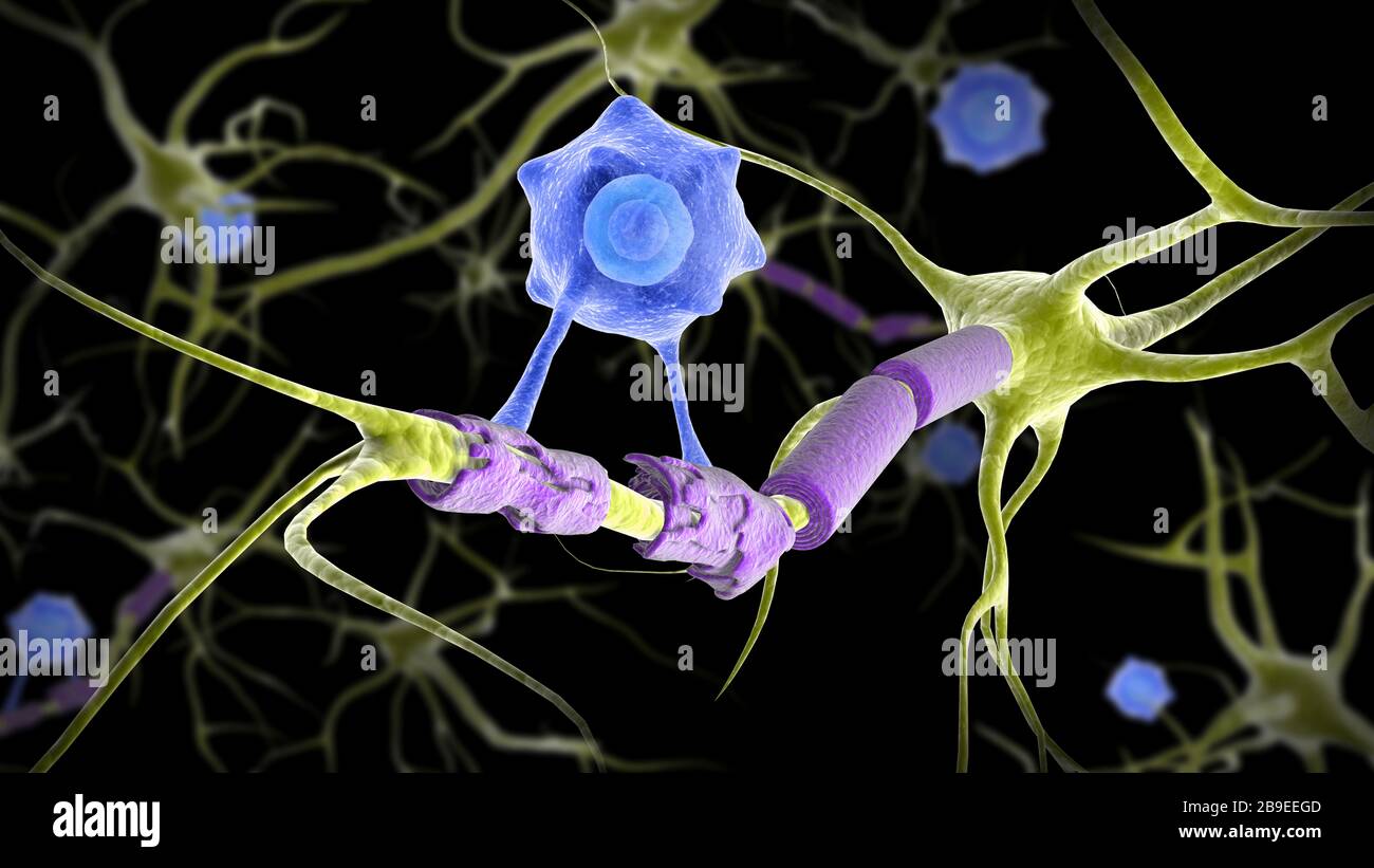 Imagen conceptual de una neurona de esclerosis múltiple curada por una célula T. Foto de stock