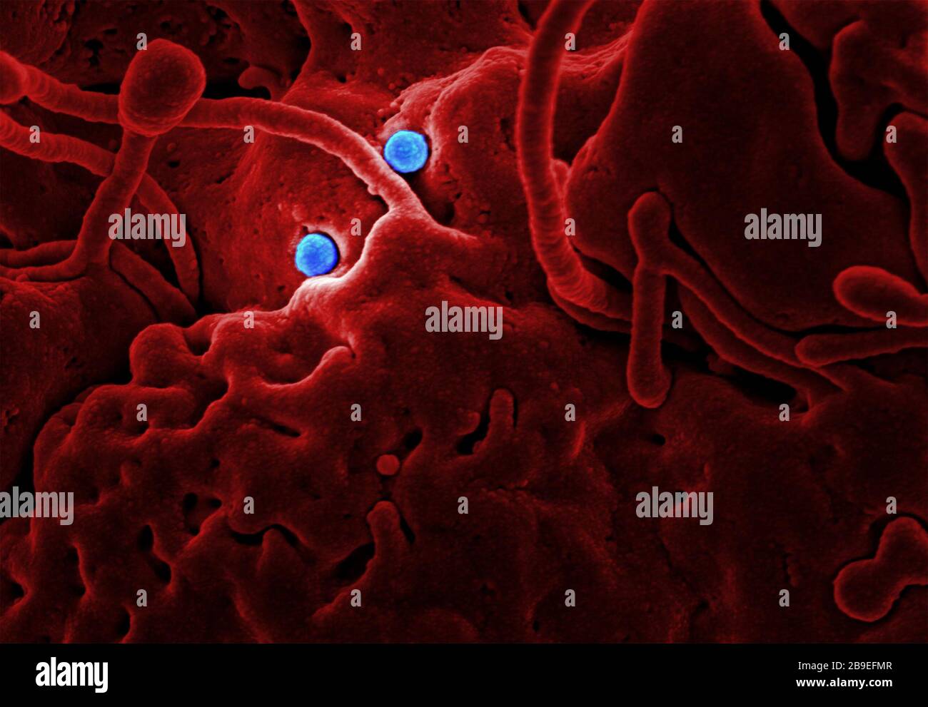 Partículas virales MERS-CoV (azul), en la superficie de una célula epitelial vino (rojo). Foto de stock