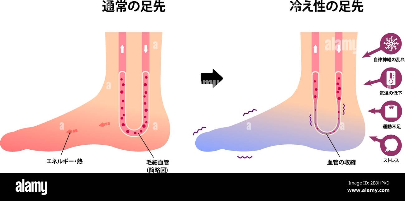 Ilustracion De La Circulacion Normal De La Sangre En Los Pies Imagen Vector De Stock Alamy