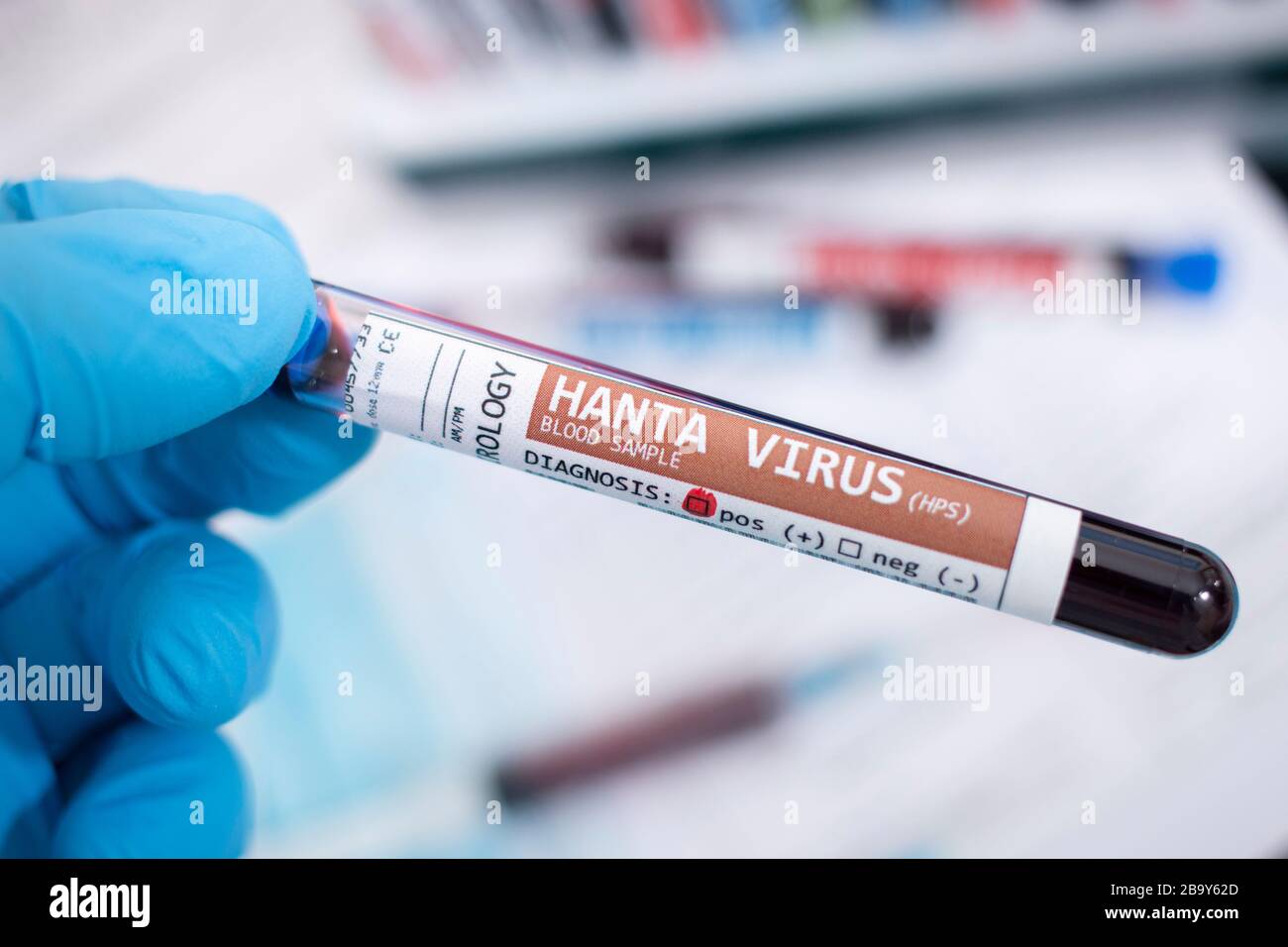 Muestras de sangre ficticias con virus de hanta infectado, con  estetoscopio, mascarilla y jeringa y otras cosas Fotografía de stock - Alamy