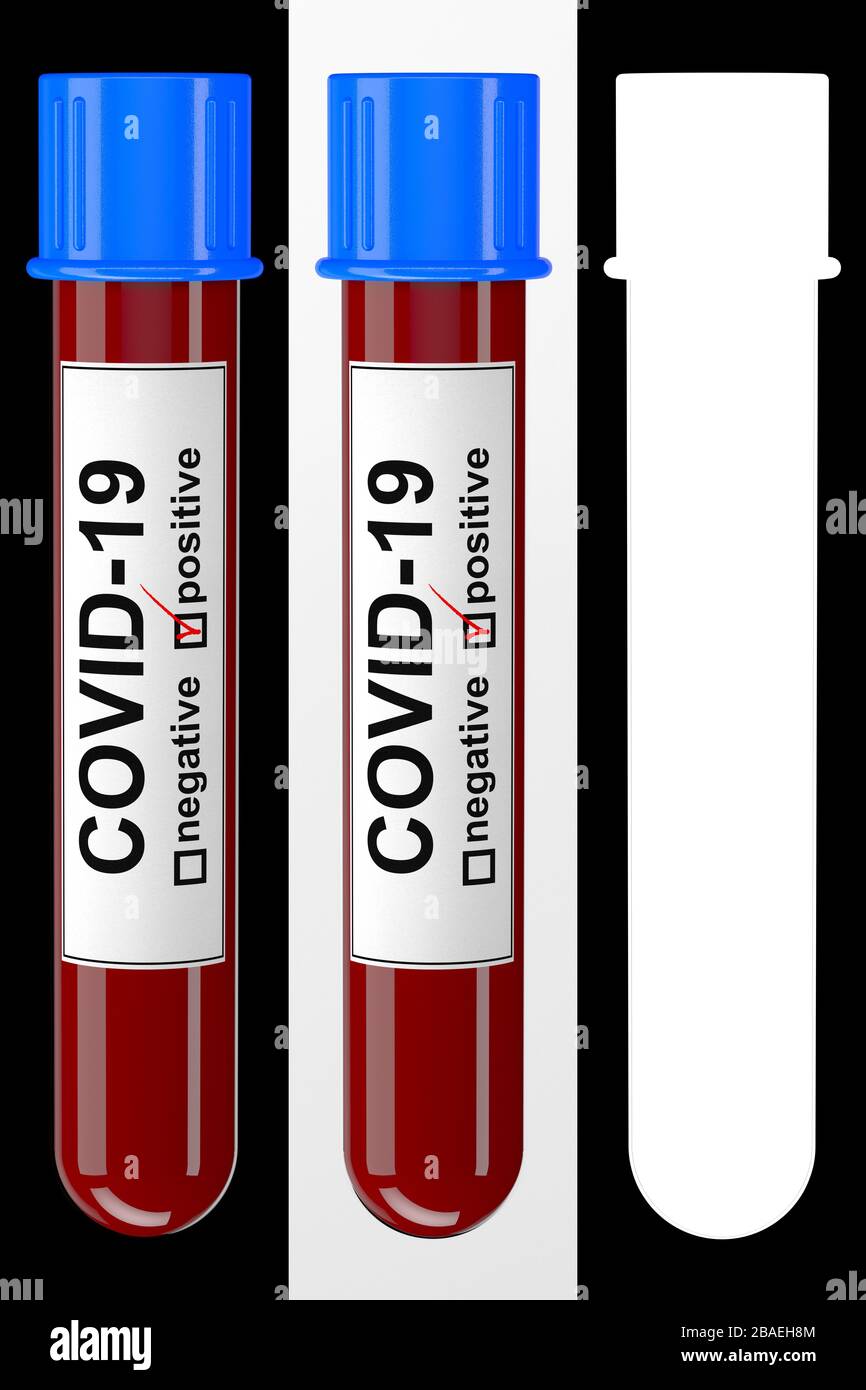 Ilustración 3D de un tubo de análisis de sangre con prueba COVID-19 positiva sobre fondo blanco y negro con mapa alfa para facilitar el aislamiento. Foto de stock