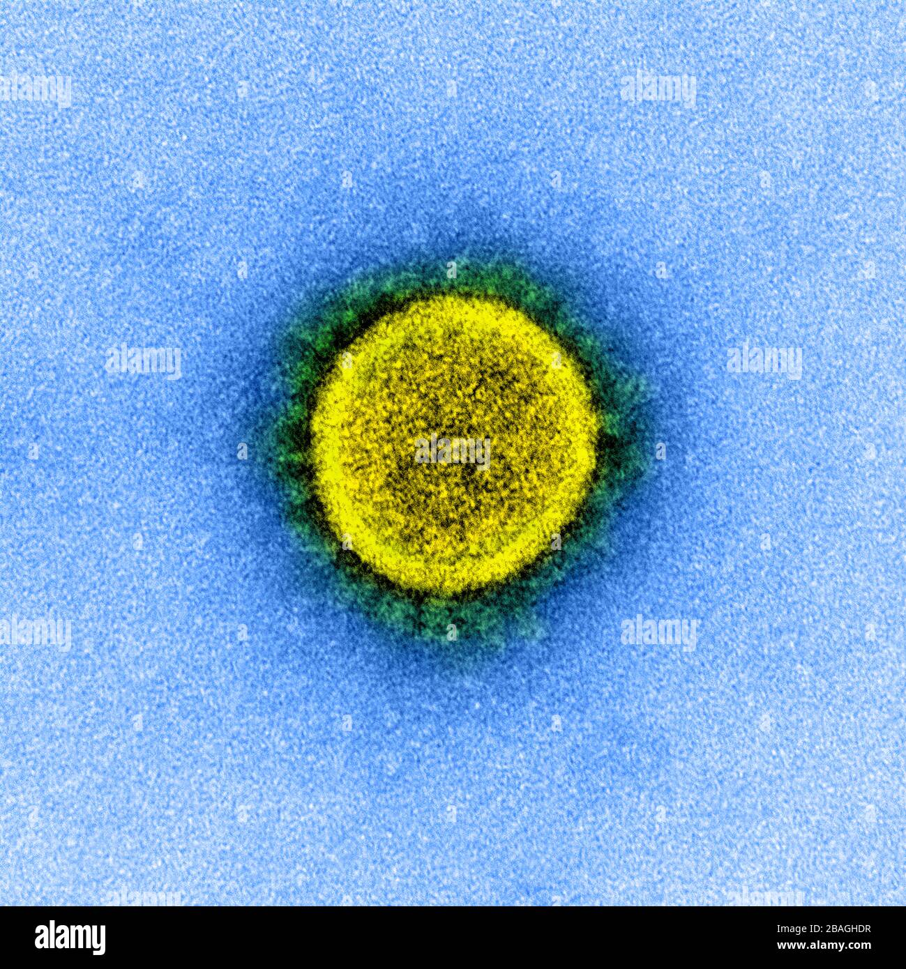 Micrográfico de electrones de transmisión de una partícula de virus de CoV-2 de SARS, aislada de un paciente. Imagen capturada y mejorada en color en la instalación integrada de Investigación NIAID (IRF) en Fort Detrick, Maryland. Foto de stock