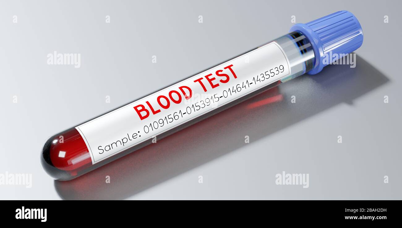 Análisis de sangre, tubo de ensayo - ilustración en 3D Foto de stock