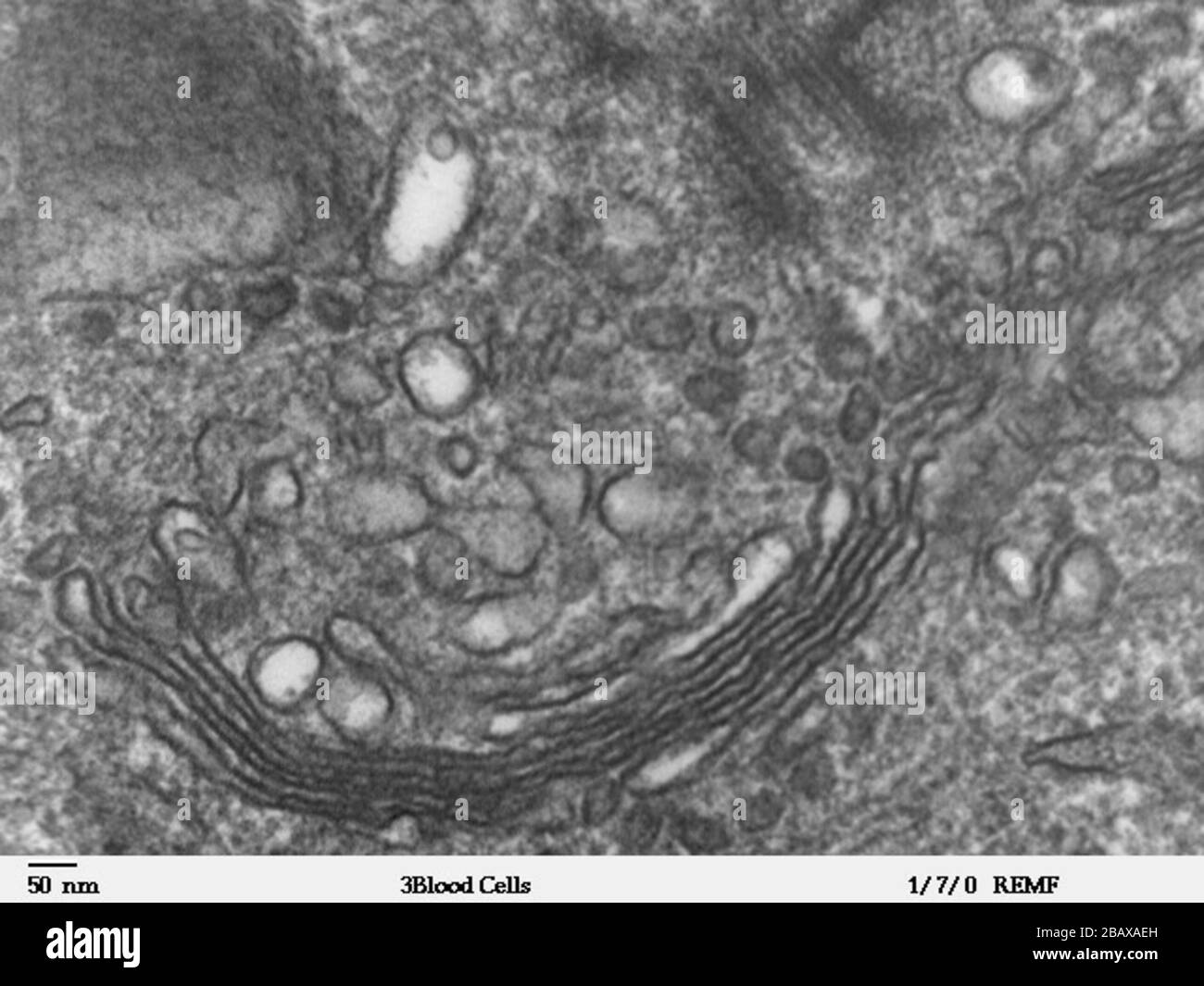 Cliente principal enseñar Imagen de microscopio electrónico de transmisión de gran aumento de un  leucocito humano, mostrando golgi, que es una estructura involucrada en el  transporte de proteínas en el citoplasma de la célula. JEOL