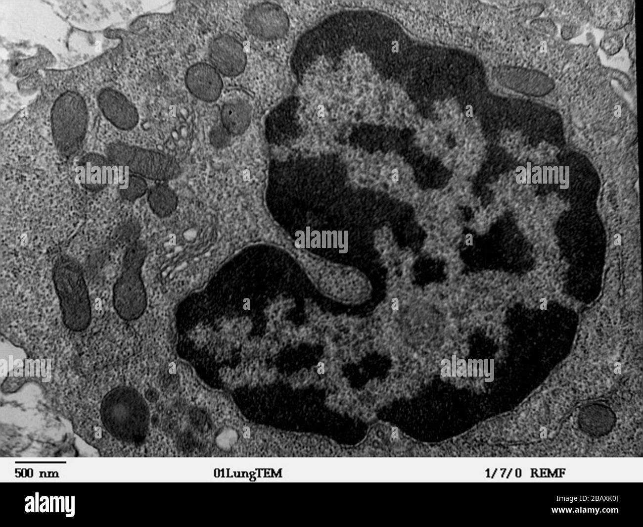 Imagen del microscopio electrónico de transmisión de una sección delgada  cortada a través de un área de tejido pulmonar mamífero. La imagen es un  macrófago en los alvéolos, mostrando el núcleo y