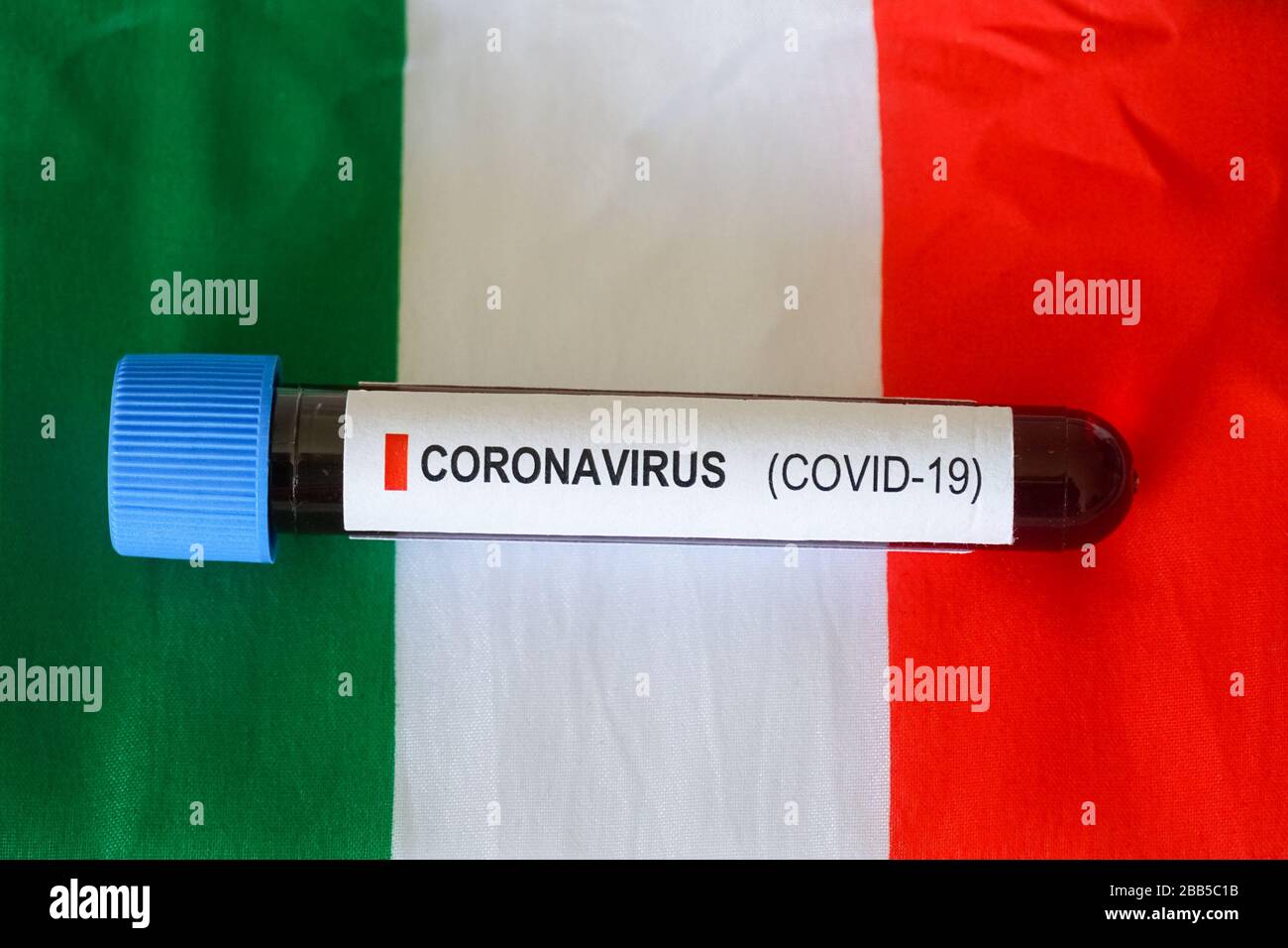 Muestra de sangre de coronavirus Covid 19, prueba de sangre del virus de SARS CoV 2 con bandera italiana al fondo Foto de stock