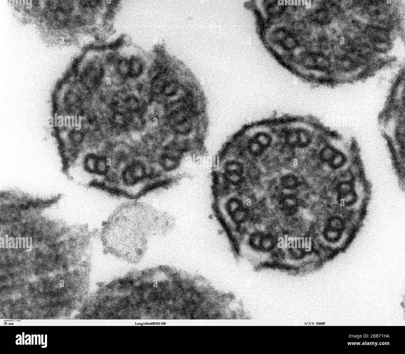 'Gran aumento de la imagen de Lung cilia8031150. Esta imagen es un