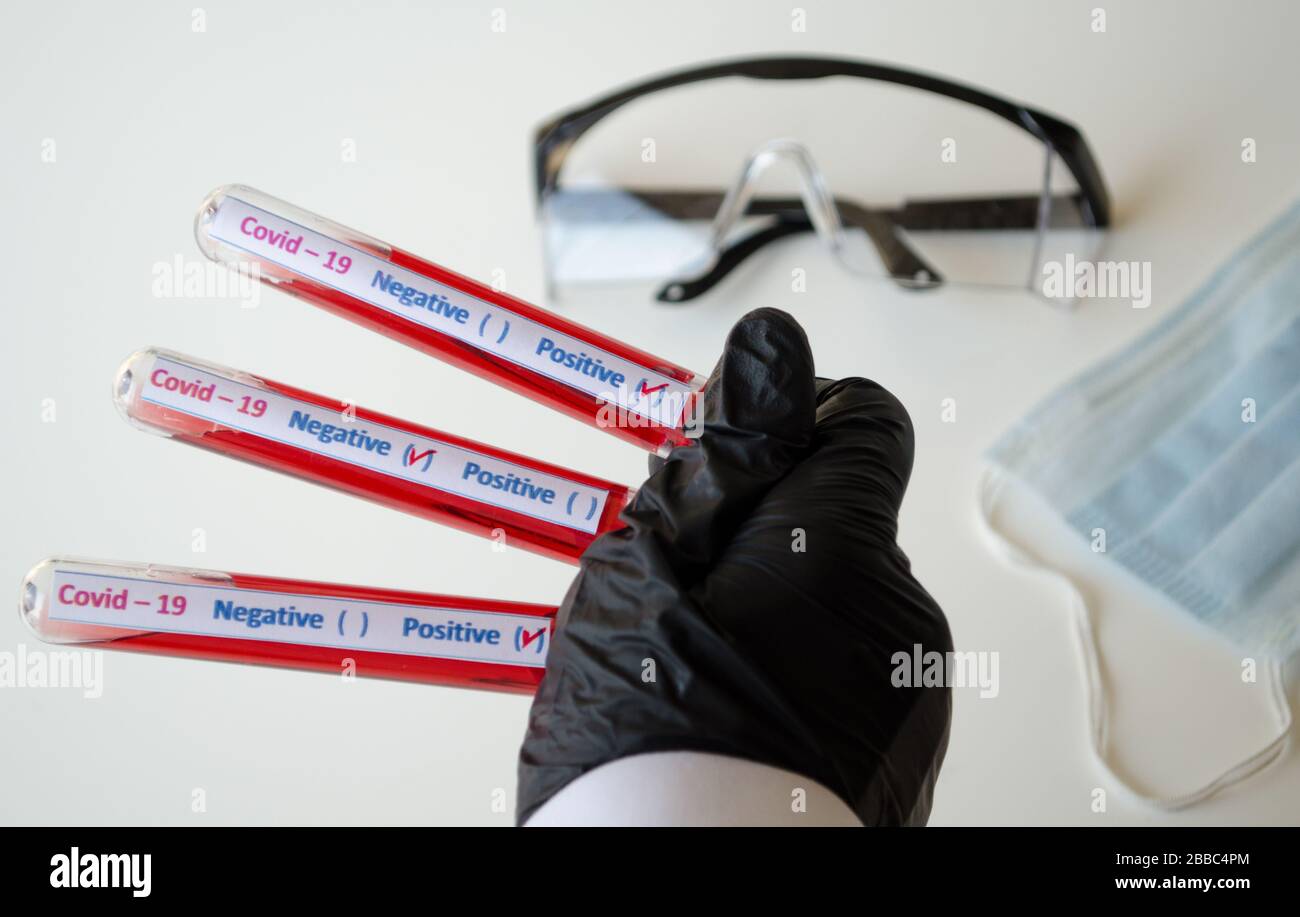 La persona sostiene tubos de análisis de sangre con coronavirus en mano enguantada, en el laboratorio Foto de stock