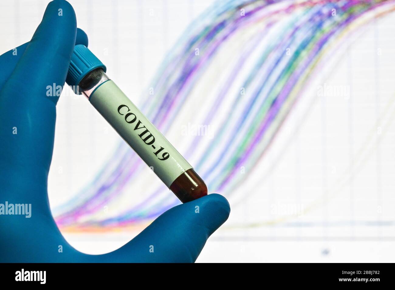 Detección por PCR del coronavirus SARS-CoV-2. Muestra de sangre para investigación sobre COVID-19. Foto de stock