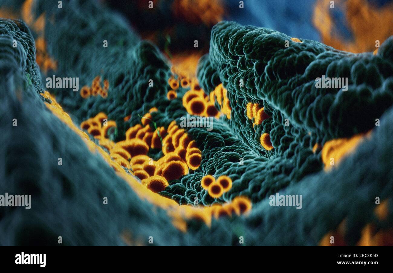 Microscopía electrónica de Coronavirus SARS COVID-19 infestando células humanas, illlustración 3D basada en fotografías microscópicas electrónicas Foto de stock