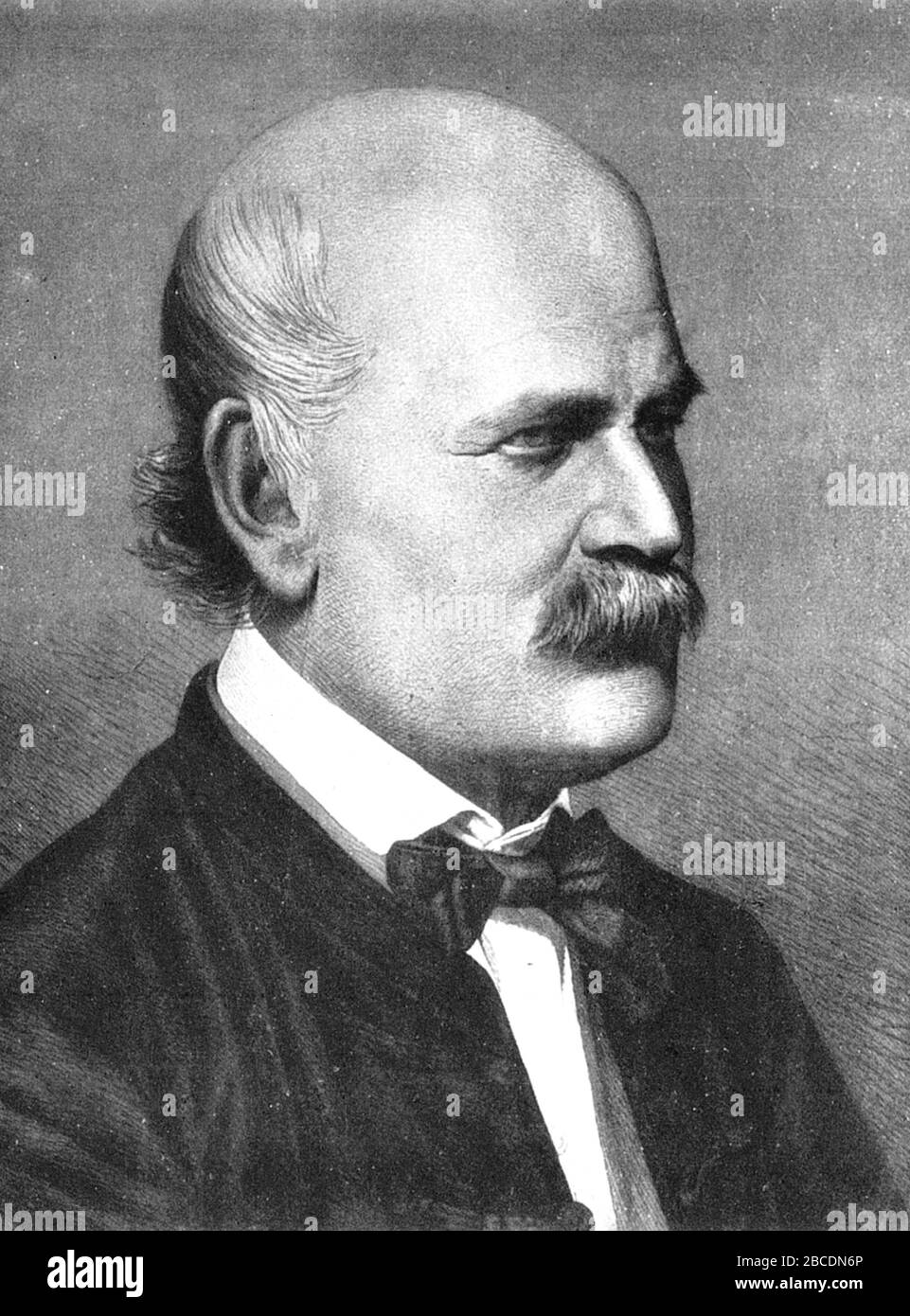 Ignaz Semmelweis, Ignaz Philipp Semmelweis (1818 – 1865) médico y científico húngaro, ahora conocido como pionero de los procedimientos antisépticos Foto de stock