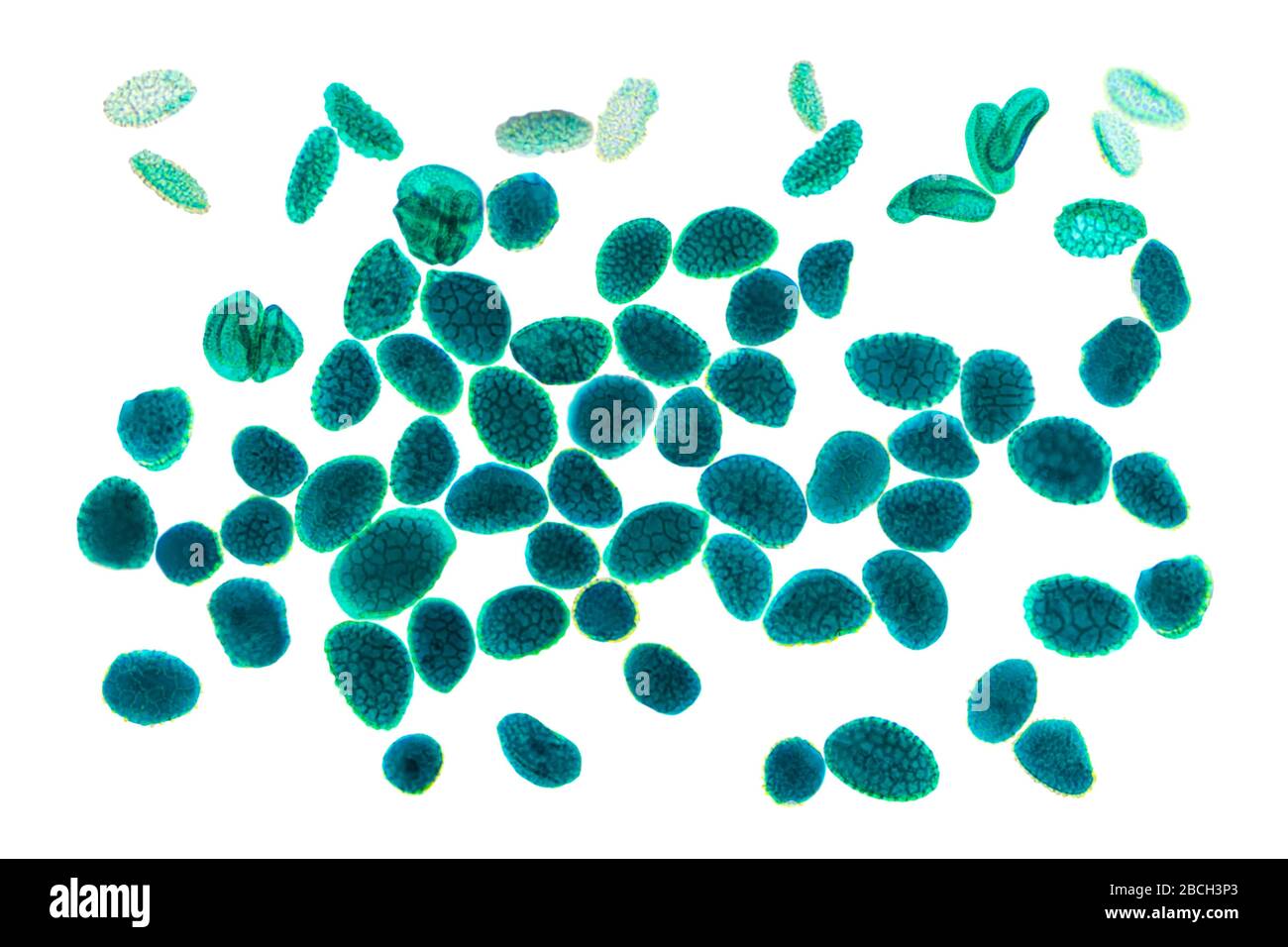 Granos de polen magnificados bajo el microscopio ligero. Los granos de polen a menudo causan reacciones alérgicas a los antígenos. Foto de stock