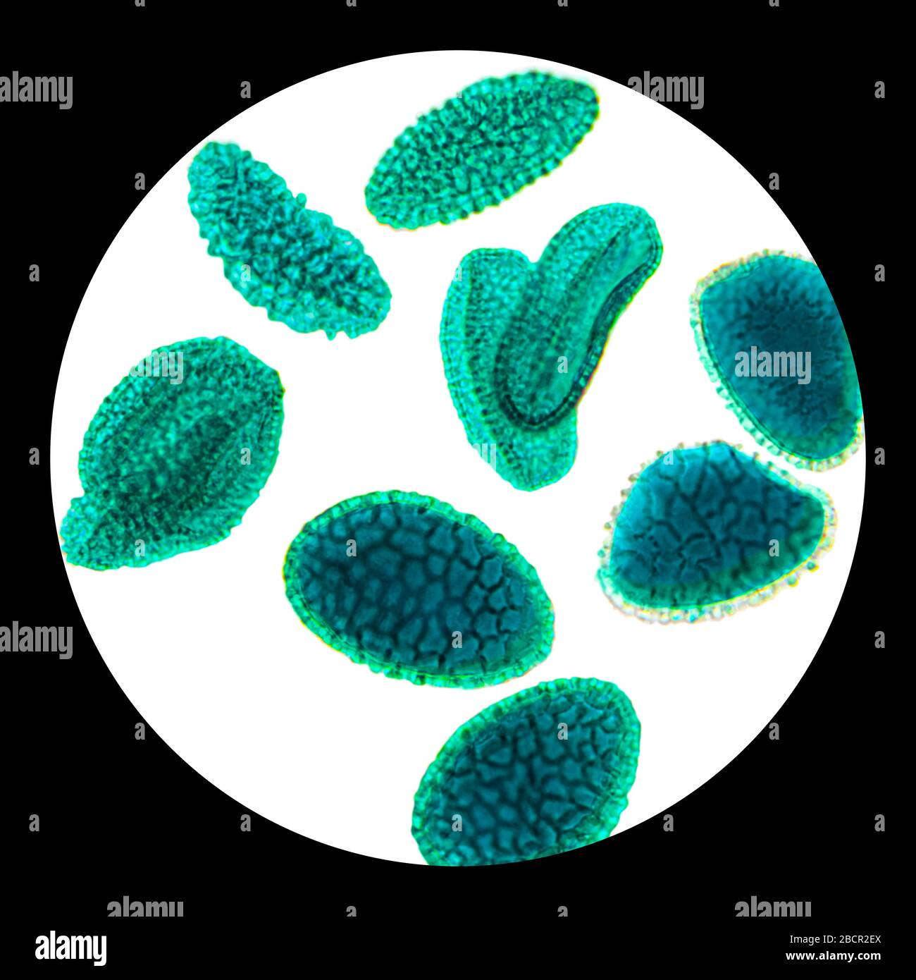 Granos de polen bajo el microscopio ligero. Los granos de polen a menudo causan reacciones alérgicas a los antígenos. Foto de stock